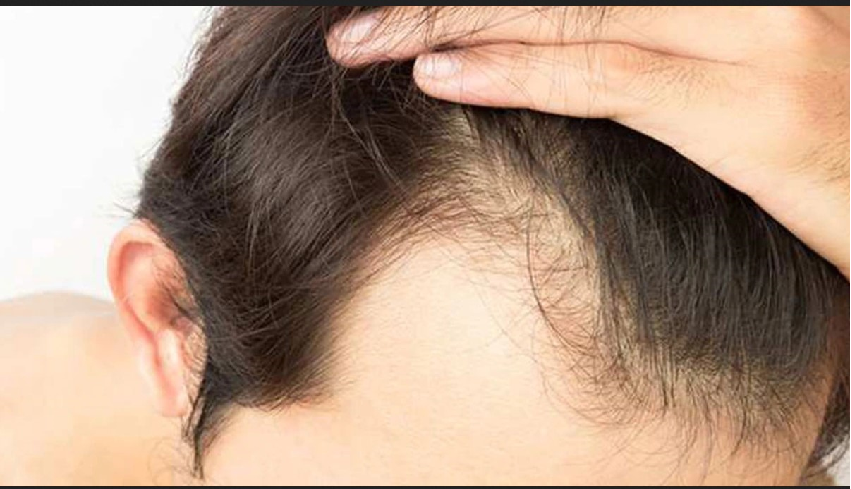 Prevent hair loss