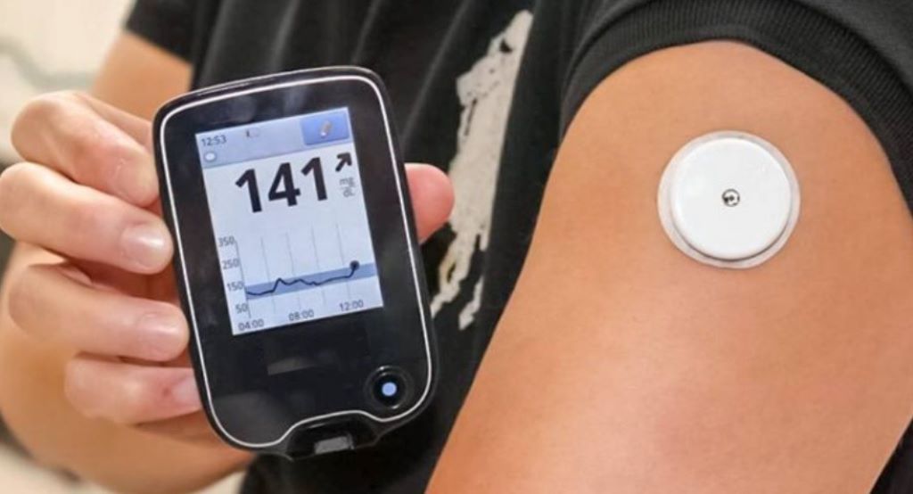 How do you use a wearable glucose monitor