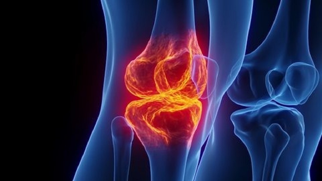 When should I see a doctor for knee pain